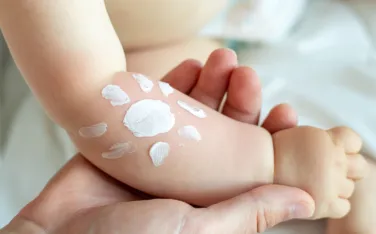 Sonnencreme kinder faz teaser