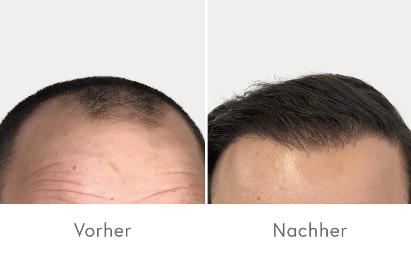 Copy-of-Nachher_DE